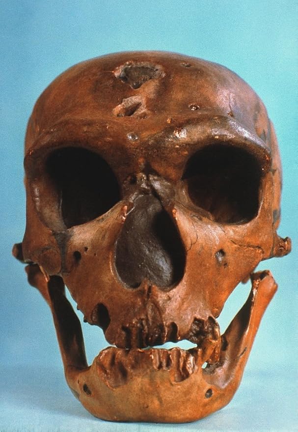 Neanderthal Skull Nfrontal View Of Typical Neanderthal Skull From La Chapelle-Aux-Saints France Poster Print by (18 x 24)