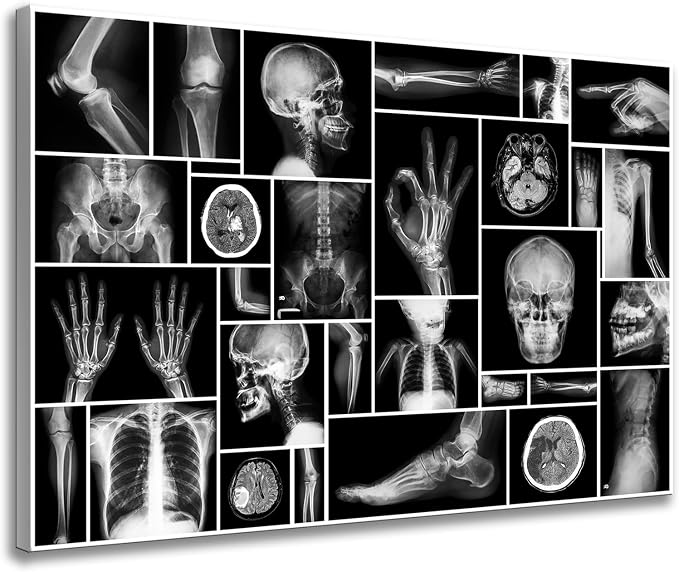 Black and White Human Skull Wall Art Canvas Painting X-Ray Picture Poster Prints Wall Picture For Hospital Orthopedic Surgeon Office Wall Decor Ready Hanging on 24x36inch (24"x36", Black and White) - skull wall art