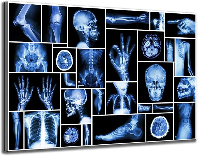 KLVOS Large Abstract Skull Canvas Art Wall Decor Black and Blue Collection Xray Multiple Part of Human Organs Gallery Wrap Canvas Prints Home Decor Giclee Print for Hospital Office Ready to Hang - skull wall art